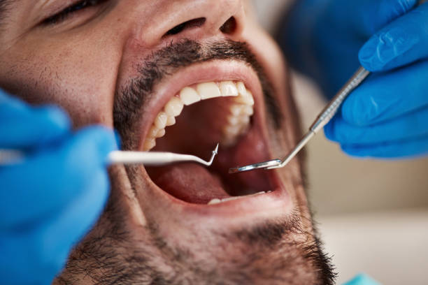Best Emergency Dental Care for Abscessed Tooth in Onancock, VA